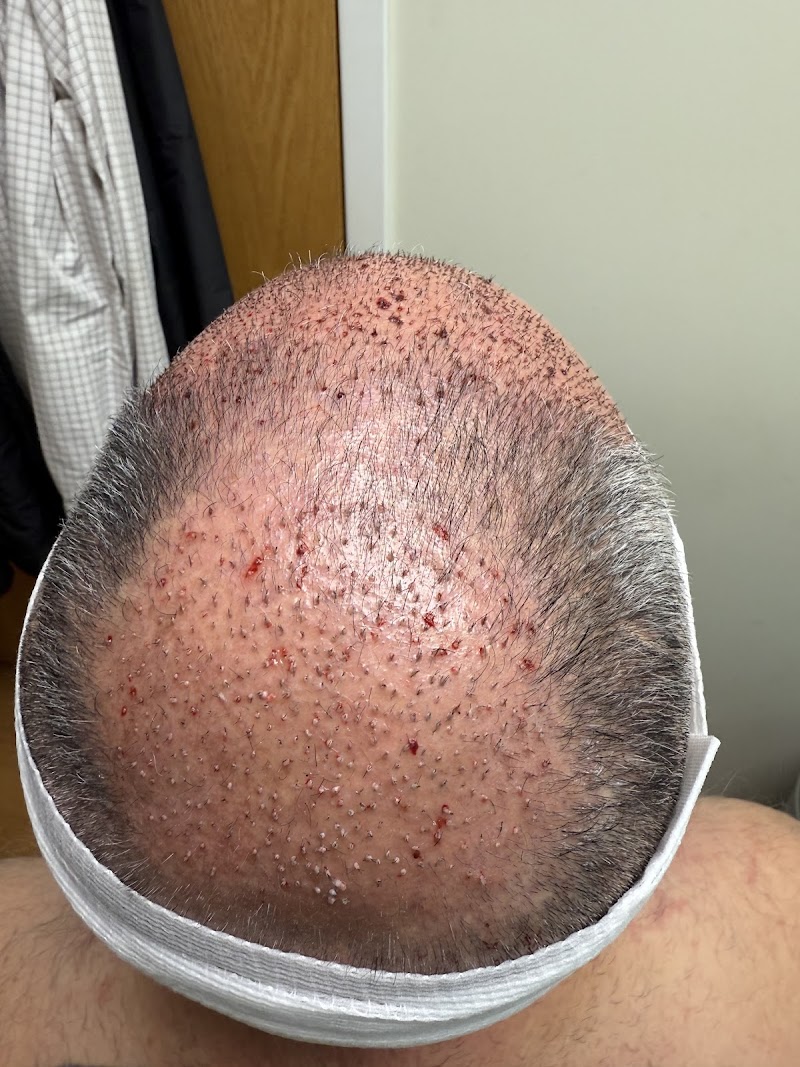Oak Brook Hair Transplant, Chicago