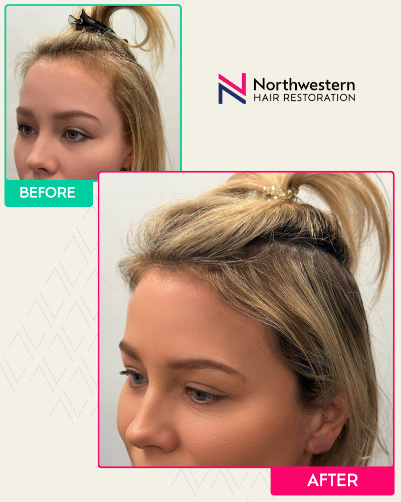 Northwestern Hair Restoration Clinic, Chicago