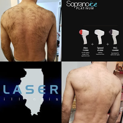 Laser Illinois